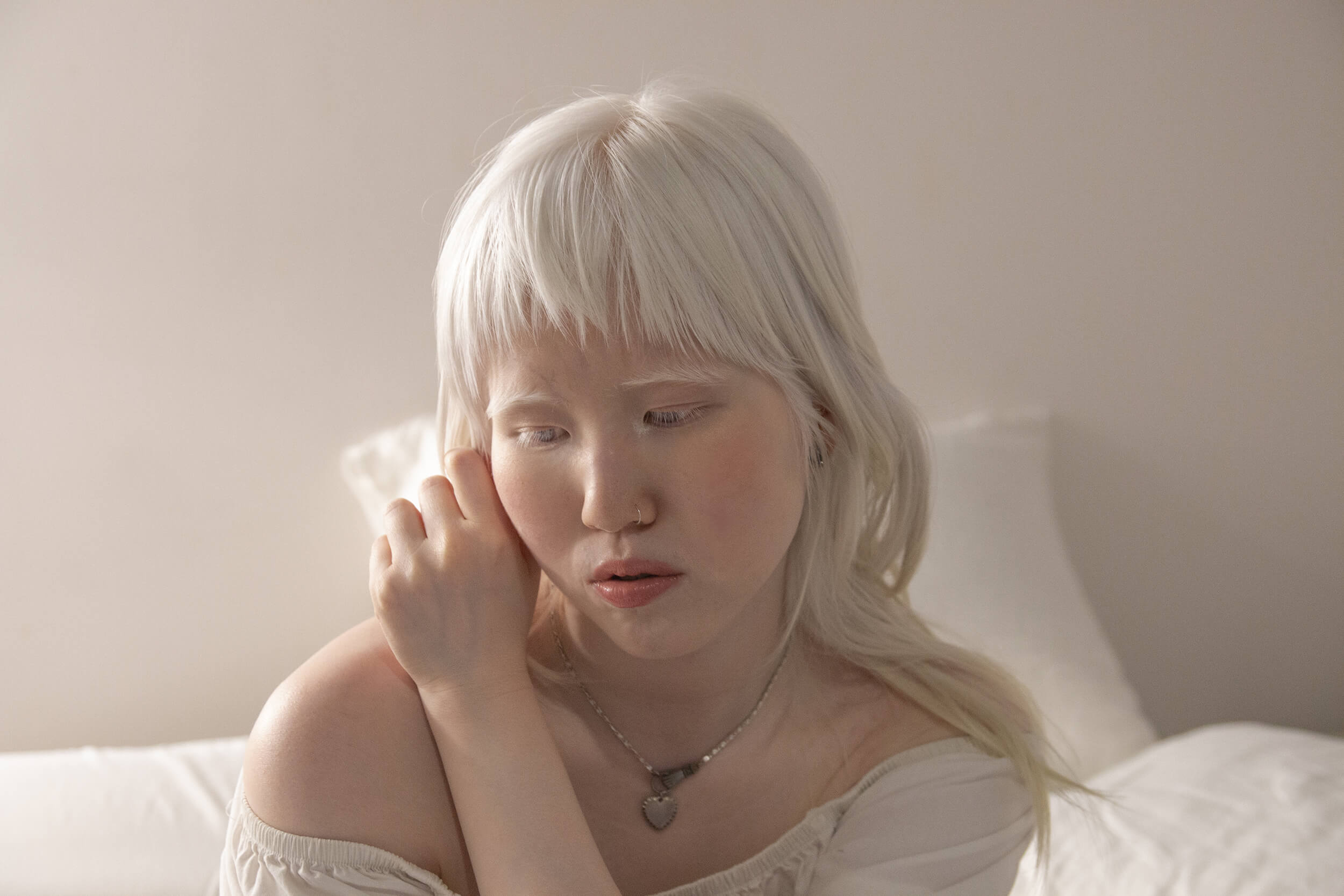 Equals in Diversity Beauty Albinism