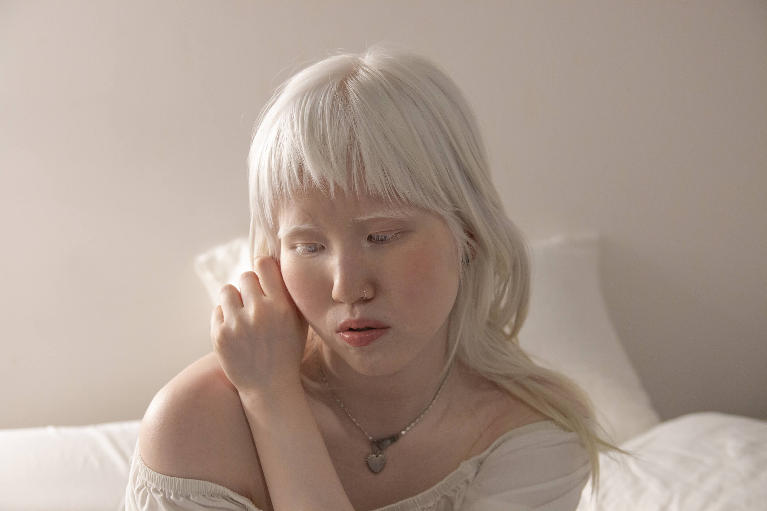 Equals in Diversity Beauty Albinism Equals in Diversity Beauty Albinism
