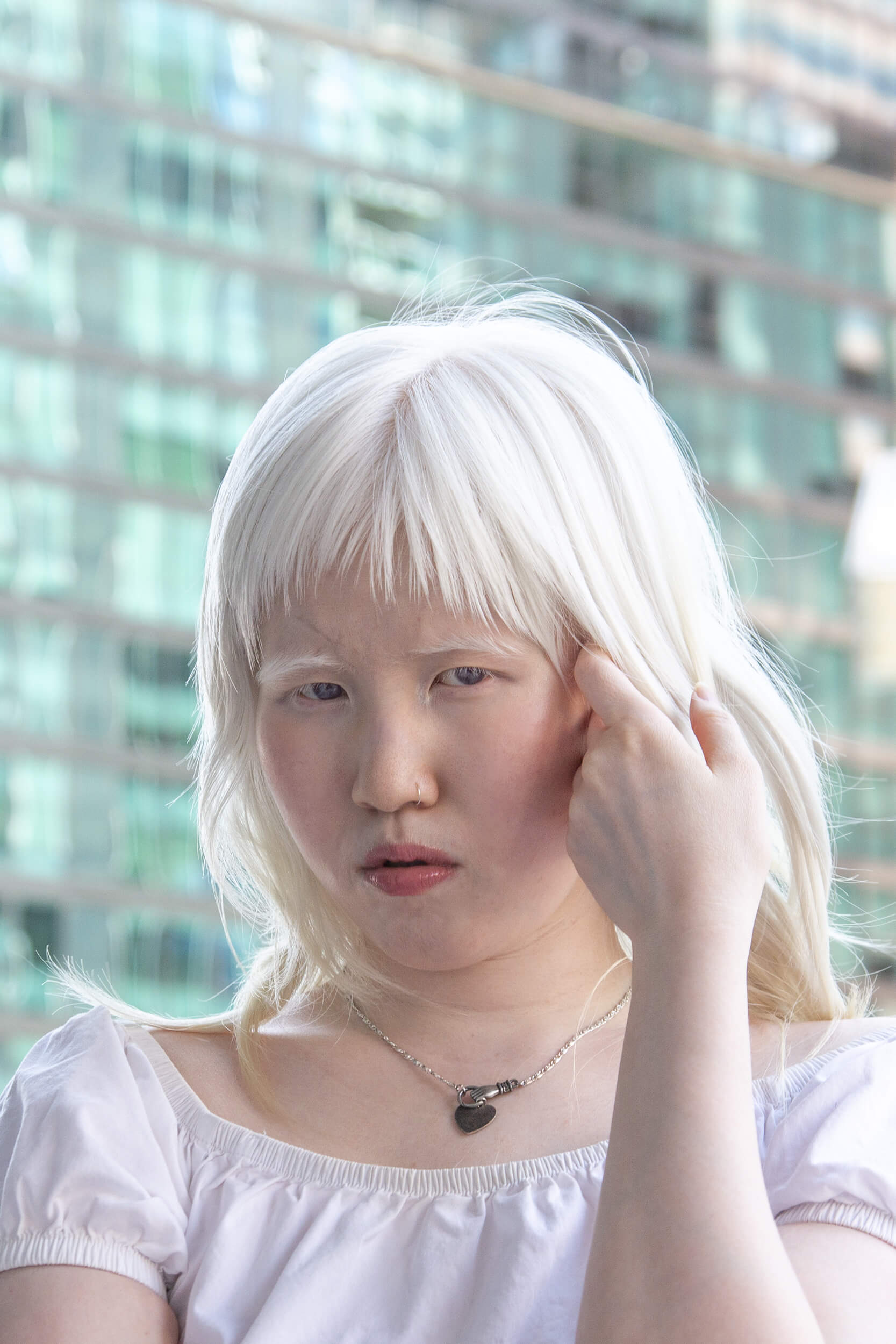 Equals in Diversity Beauty Albinism