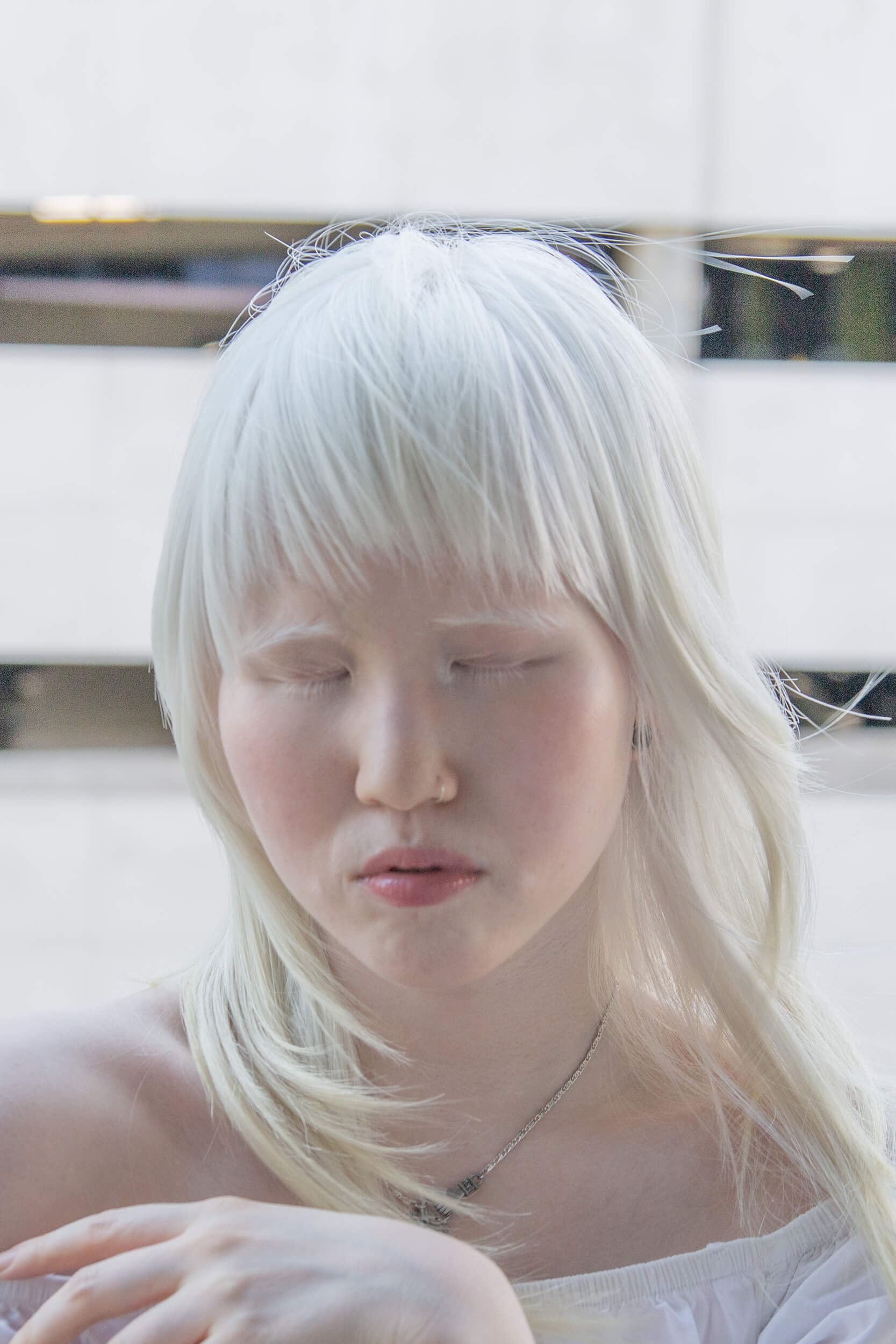 Equals in Diversity Beauty Albinism Equals in Diversity Beauty Albinism
