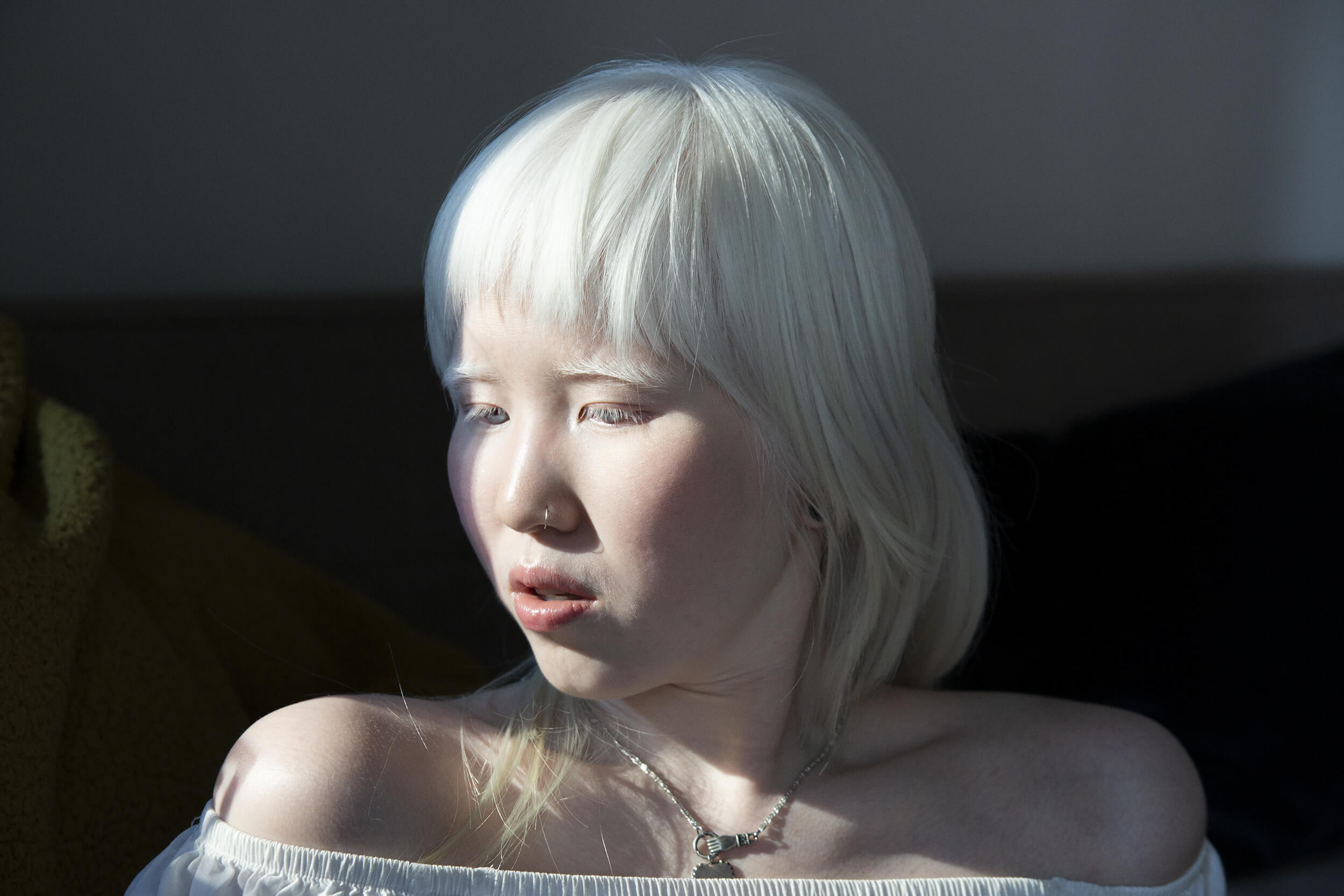 Equals in Diversity Beauty Albinism