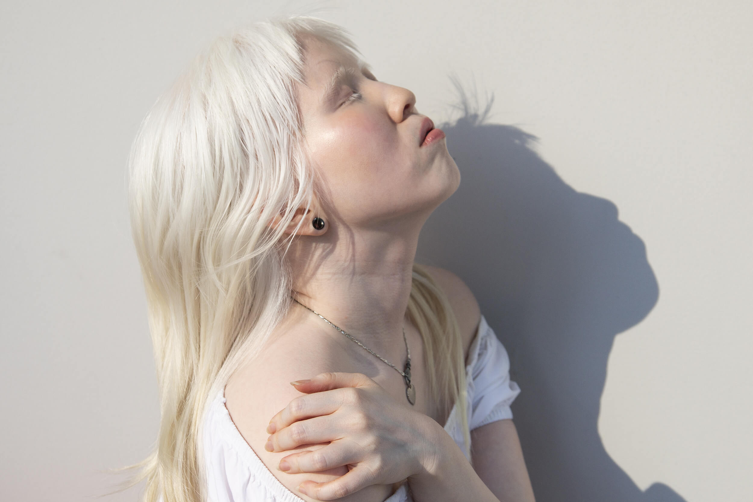 Equals in Diversity Beauty Albinism Equals in Diversity Beauty Albinism