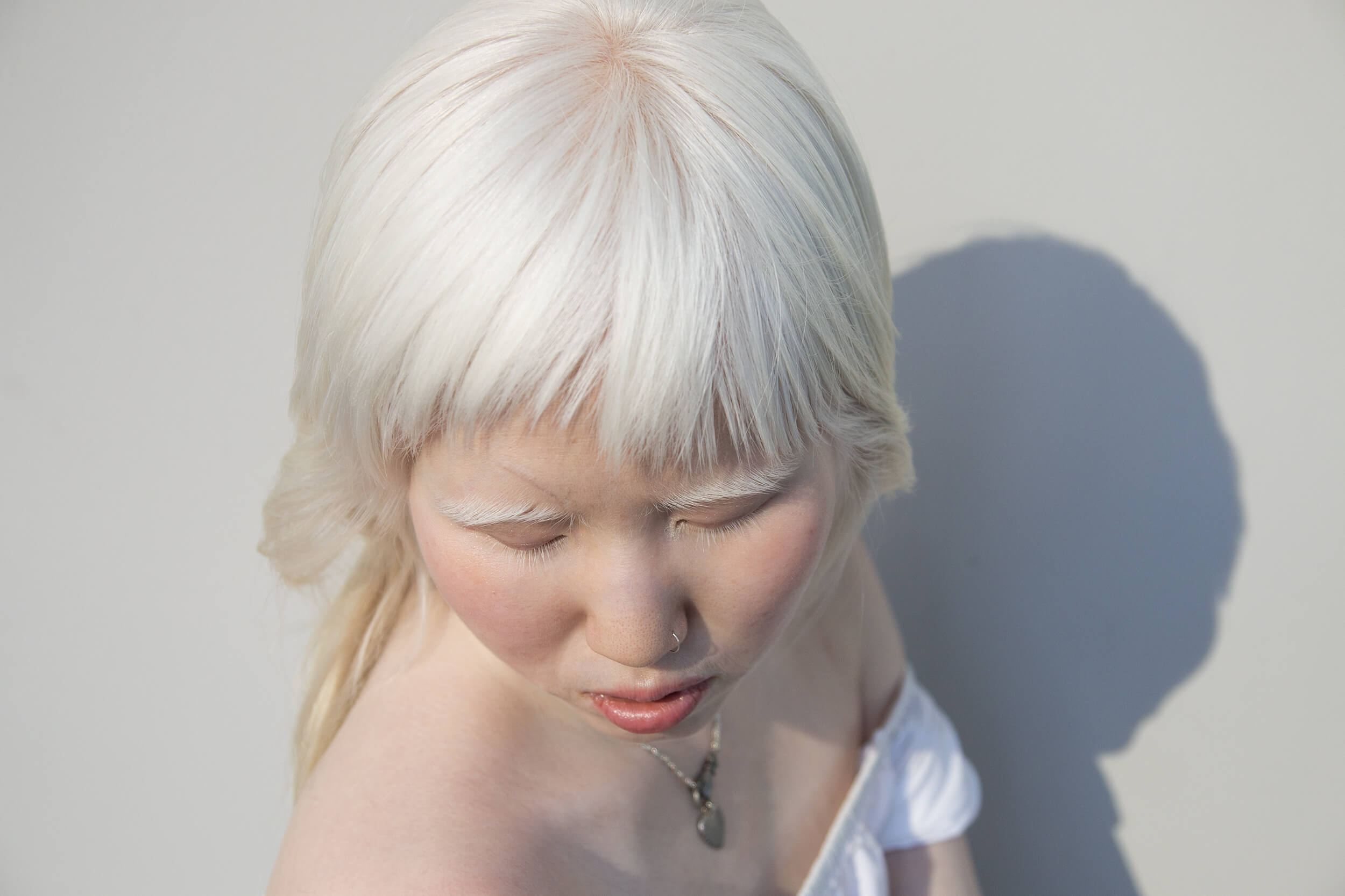 Equals in Diversity Beauty Albinism