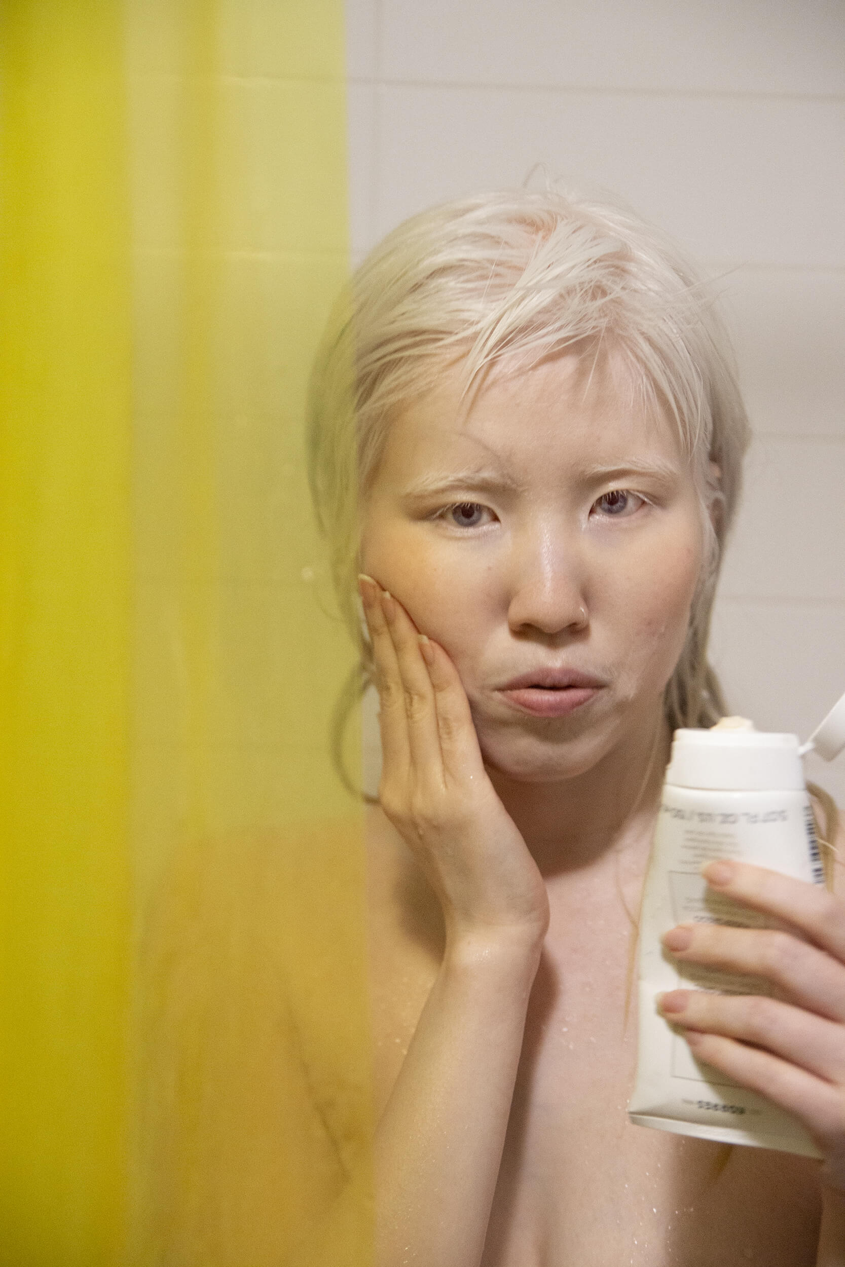 Equals in Diversity Beauty Albinism Equals in Diversity Beauty Albinism