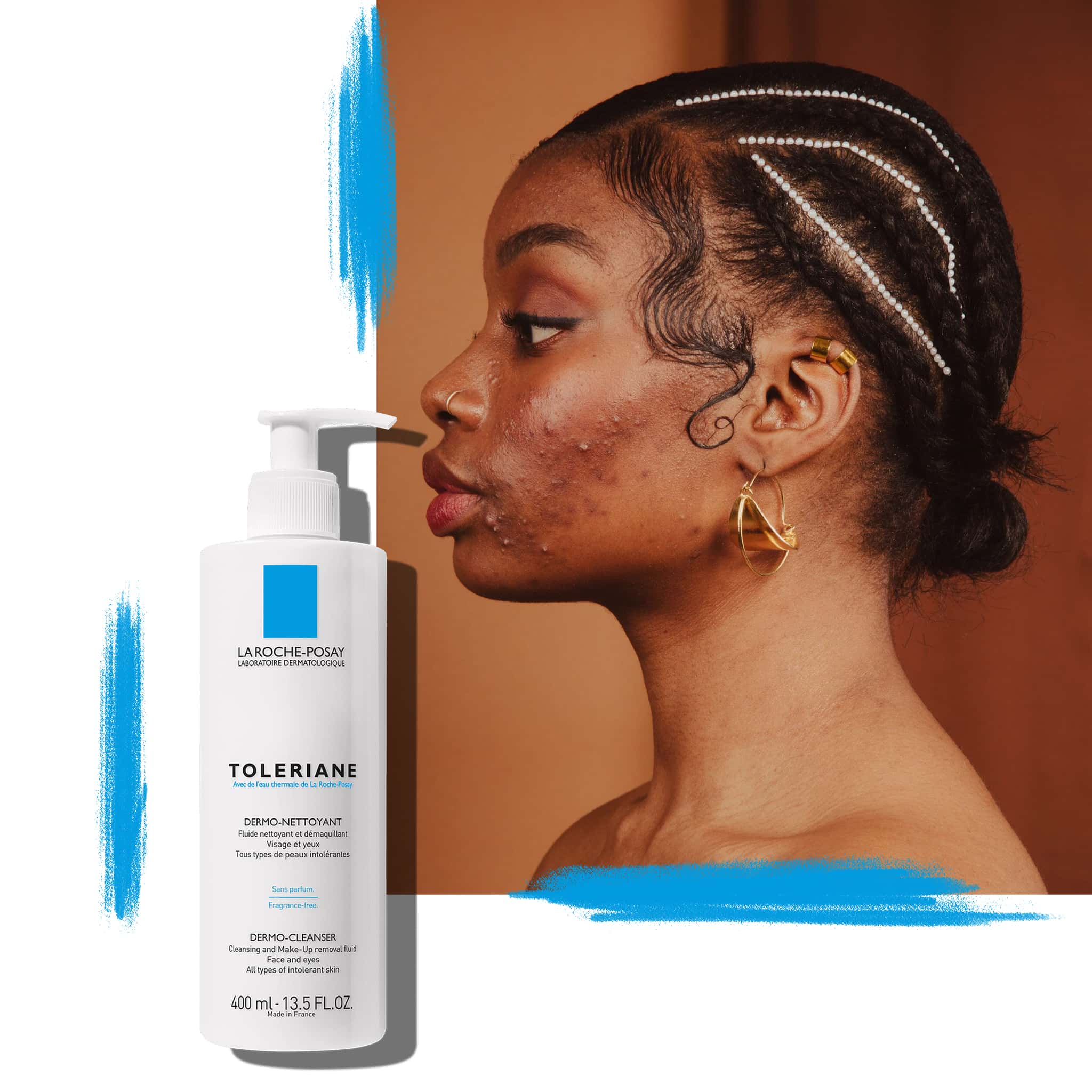 4 Complete Guide to Imperfections