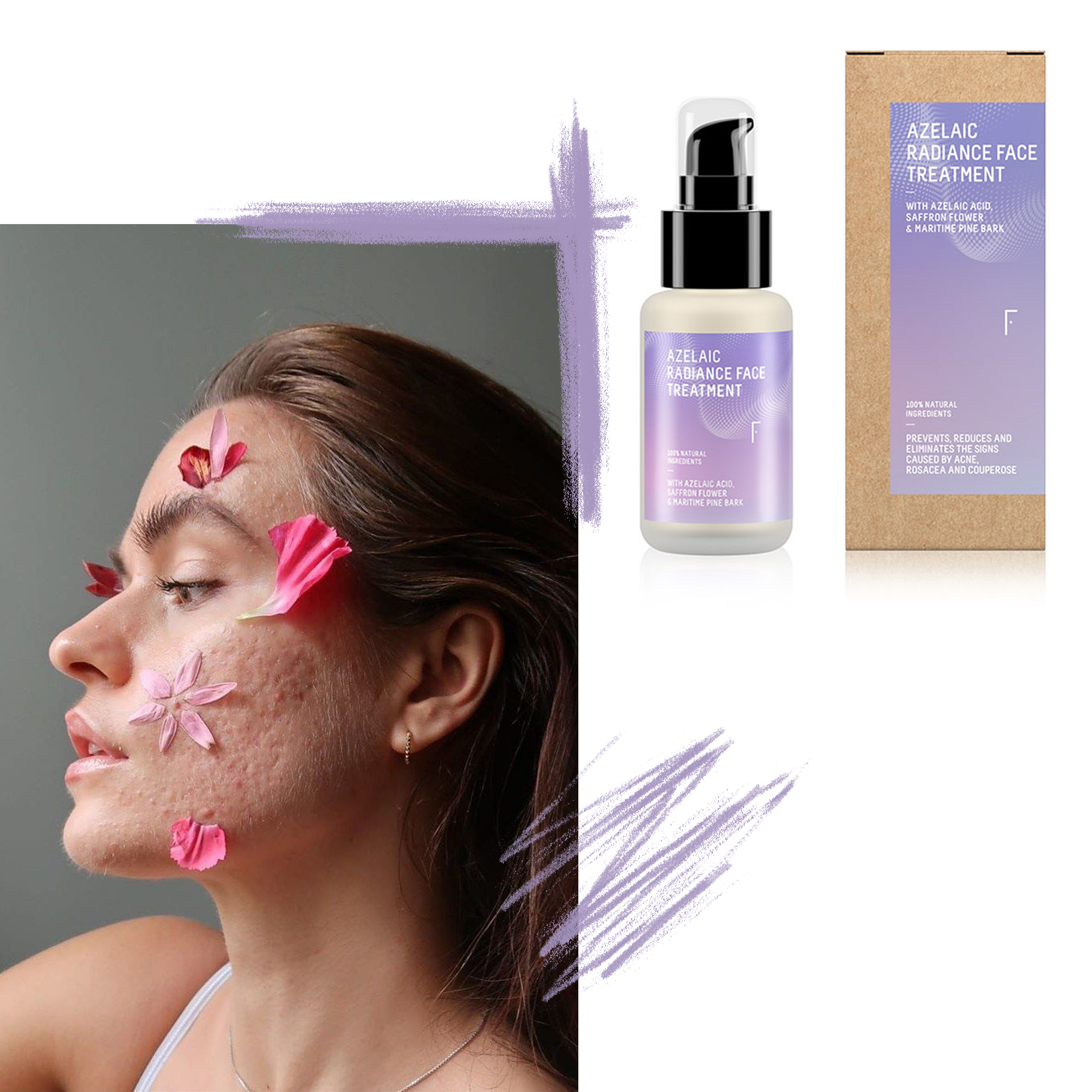5 Complete Guide to Imperfections